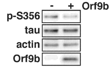 マウス神経細胞にSARS-CoV2由来Orf9bを発現させ、タウのリン酸化をリン酸化抗体で検出した