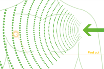 “できる”から“使える”へ。3次元超音波画像の実用化を加速する技術革新